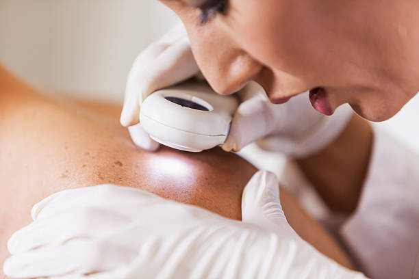 SKIN CANCER AFFECTS 1 IN 5 ADULTS: HERE'S WHY YOU CAN'T AFFORD TO GHOST YOUR SPF